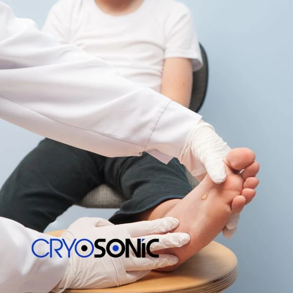 Are you looking for fast effective wart removal Contact us today Cobham
